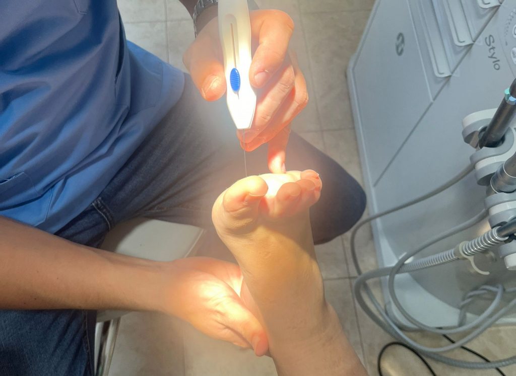 PODOLOGO TRATANDO EL DOLOR EN LOS TALONES